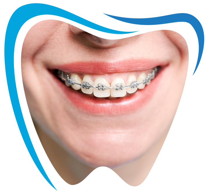 Best Orthodontics Kavadiguda