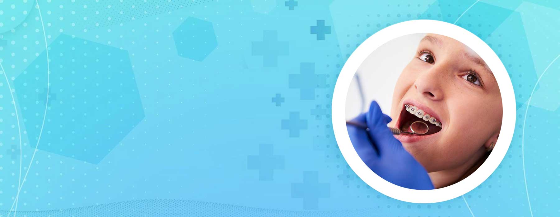 Orthodontics Specialist In Secunderabad